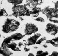 img149659 1 5 Belyiy chugun struktura e1667592898336 % Графитизация